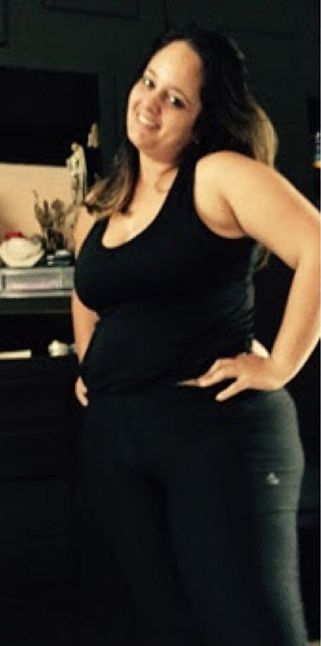 Before bariatric surgery